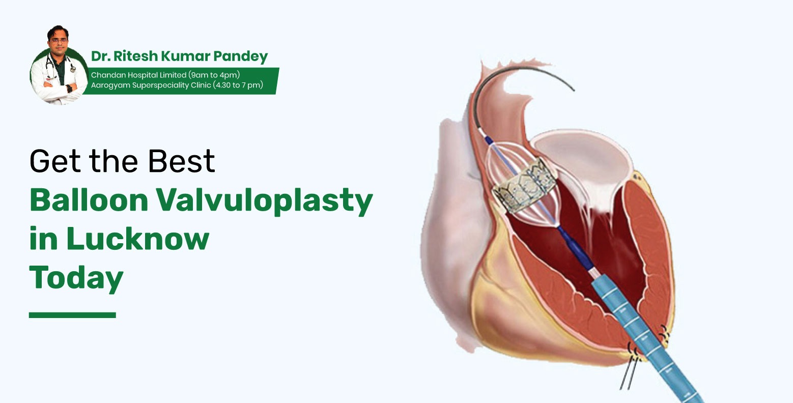 best-balloon-valvuloplasty-lucknow