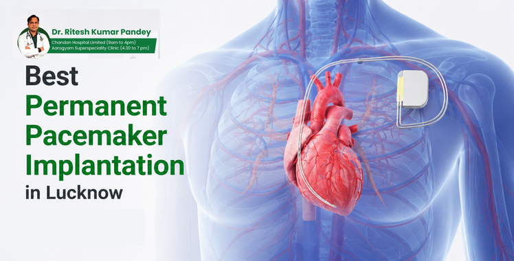 Best Permanent Pacemaker Implantation in Lucknow – Expert Cardiologist