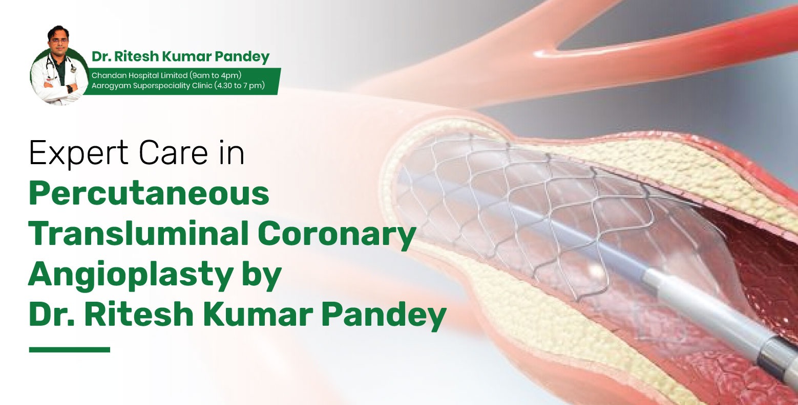 Expert Care in Percutaneous Transluminal Coronary Angioplasty by Dr. Ritesh Kumar Pandey