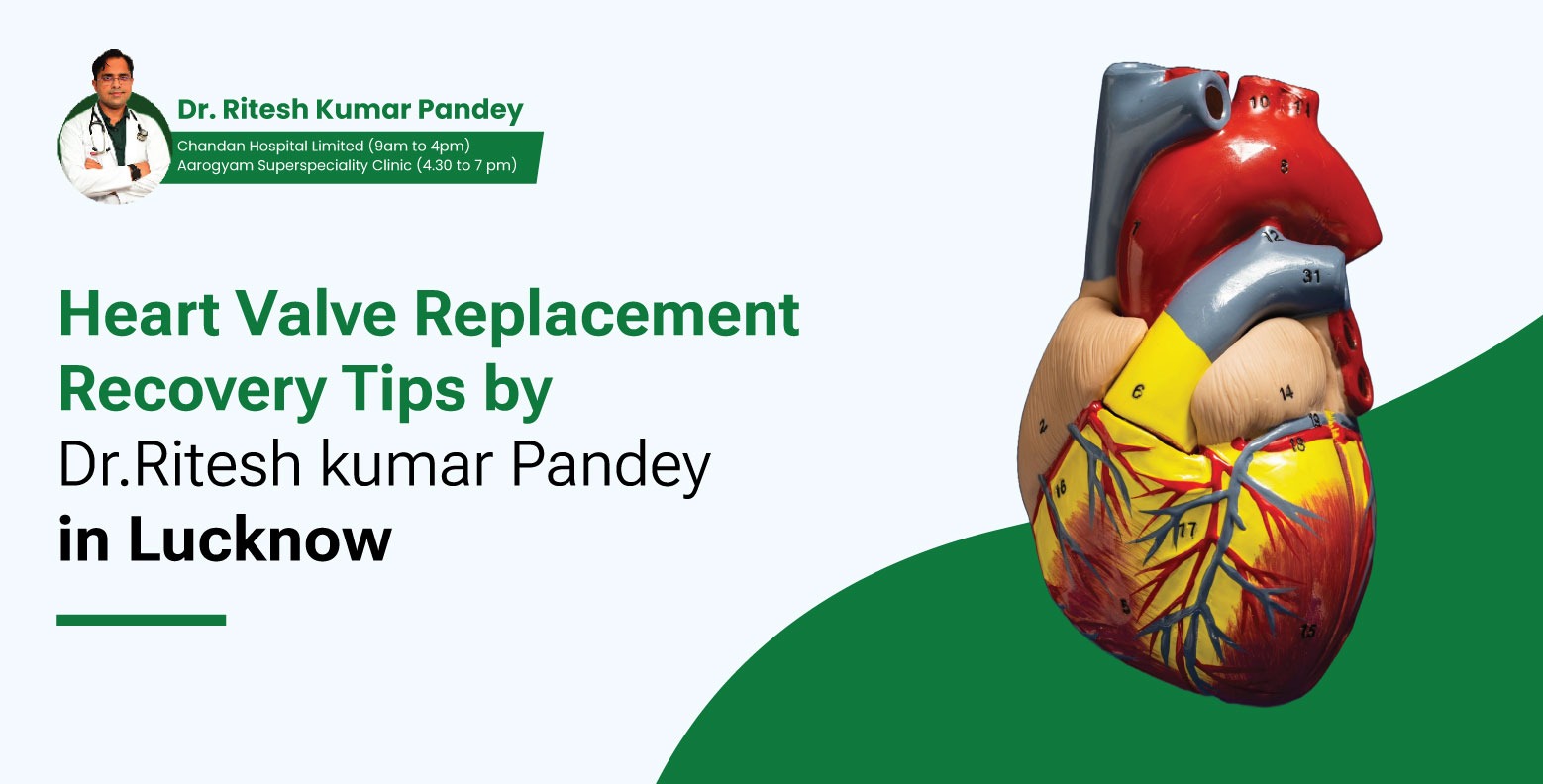 Heart valve replacement in Lucknow