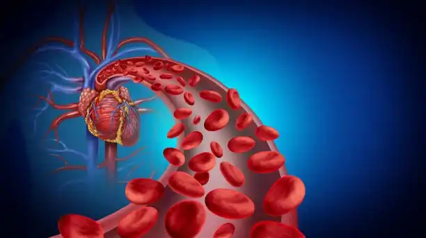 Coronary Angiography